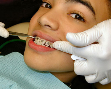 Kids Jacksonville: Orthodontists - Fun 4 First Coast Kids
